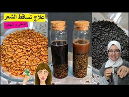 علاج تساقط الشعر بعد الولادة و علاج فروة الراس للشعر الذهني و الجاف مع الحاجة فاطمة youtube in 2021 hair care hair beauty