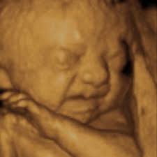 Some typical uses for the date calculators; Parentune 26 Weeks And 7 Days Pregnant Baby Fetal Progress Ultrasound Nutrition Tips And Advice