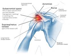 Joints have bursae around them, and because the hip joint is so large it has many bursae, around 20 total. The Effect Of Posture On Shoulder Pain Best Physical Therapy Nyc