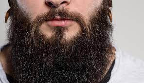 Beard hair transplant to head. 4 Reasons Beard Hair Is A Great Option For Hair Transplants