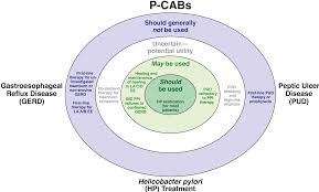 Image result for Potassium Competitive Acid Blocker