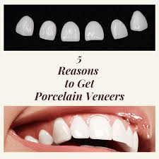 Veneers can hide stained, chipped, and uneven teeth. 5 Reasons To Get Veneers Empire Dental