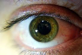 Check spelling or type a new query. 6 Rare And Unique Eye Colors Owlcation