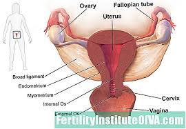 Kehadiran fibroid besar di dalam dan sekitar rahim dapat membuat hubungan seksual sangat menyakitkan bagi seorang wanita. Ketahui Sekiranya Sakit Pelvis Anda Kerana Fibroid Rahim Perubatan 2021