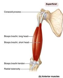 Here's an easy one for you. Exercise Learning Active Life Physiotherapy Rehab Facebook