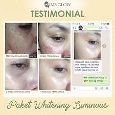 Pin Di Ms Glow Trenggalek