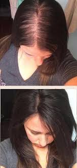 Dark Brown Hair Toppers For Women With Thinning Hair Or Hair Loss How To Get Instant Vol Thick Hair Styles Thin Hair Styles For Women Extensions For Thin Hair