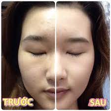 Product overview ingredients table customer reviews. Eucerin White Therapy Concentrate Serum Testimoni Malayboyal