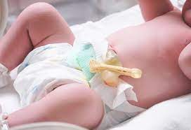 You should give your baby a sponge bath until: Caring For Your Baby Umbilical Cord Signs Treatment