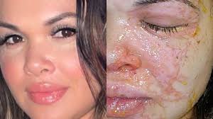 Fundraiser for Julia Vera by Alessandra Di Maggio : Help Julia recover from  this terrible accident