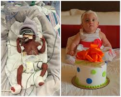 Premature babies have extra nutritional needs. Photos Of Premature Babies Then And Now Show Their Incredible Journey Huffpost Life