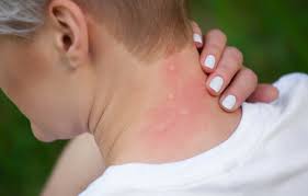 We did not find results for: Mosquito Buzz West Nile Virus