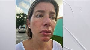 Owner of Pit Bull Who Attacked Woman, Dog in Fort Lauderdale Apologizes