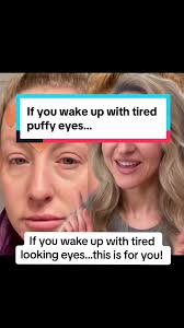 How to Apply Frownies Around Mouth: Smile Line Prevention Tutorial