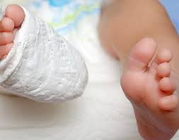 Clubfoot can affect one foot or both feet. Clubfoot Stanford Children S Health