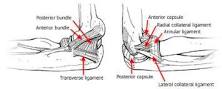Image result for what is the surgical treatment for a displacement elbow