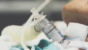 Image result for how to treatment secretions in trach patient