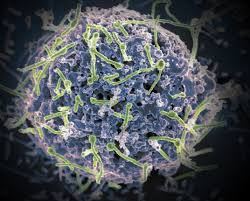 Ebola 2 download | ebola 2 is created in the spirit of the great classics of survival horrors. Ebola Virus Lessons From A Unique Survivor Nih Director S Blog