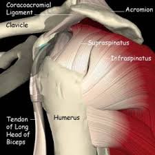 Image result for Rotator Cuff Rupture