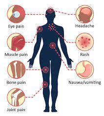 Последние твиты от dengue fever (@denguefever). Symptoms And Treatment Dengue Cdc