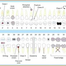 Primary Teeth Dental Chart Www Bedowntowndaytona Com