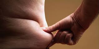 How To Tighten Loose Skin While Losing Weight