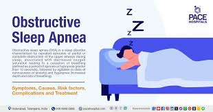 Obstructive Sleep Apnea - Causes, Symptoms, Diagnosis & Treatment