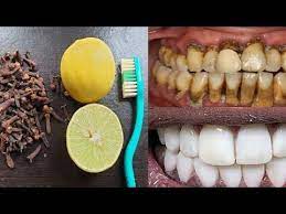 Esta Increible Receta Aclarara Los Dientes Amarillos Sucios Como En So Blanqueamiento De Dientes Casero Blanqueamiento Natural De Dientes Enjuague Bucal Casero