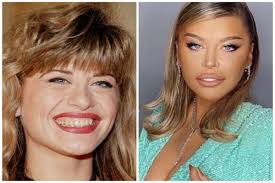 Loredana groza was born in onesti, romania on wednesday, june 10, 1970 (generation x). Loredana Groza Broke Out After Fans Told Her She Had Completely Changed The Artist Made Controversial Revelations About Cosmetic Surgery I Have No Intervention