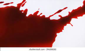 Check spelling or type a new query. Blood On White Floor Stock Photo Edit Now 396208282