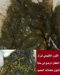 البراز الاخضر عند الاطفال الرضع 11 سبب ا مع صور حقيقية الحمل انسايد