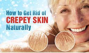How to get rid of crepey skin naturally. How To Get Rid Of Crepey Skin Naturally Beautiful On Raw