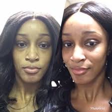 ADVANCED DERMATOLOGY AND COSMETIC SURGERY