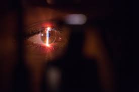 Información y consejos sobre salud: Glaucoma Quais Sao Os Sintomas E Como Prevenir Essa Doenca Nos Olhos Revista Galileu Saude