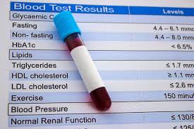 40 or higher for men and 50 or higher for women is acceptable Making Sense Of Cholesterol Tests Harvard Health