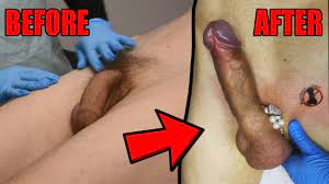 Dick Wax Depilation by Cute Esthetician. BEFORE and AFTER - Pornhub.com