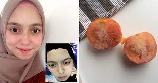 Tomato juga mempunyai manfaat untuk kecantikan kulit termasuk menghilangkan parut jerawat. Hanya Guna Petua Tomato Beku Kulit Berjerawat Berparut Kembali Pulih Jadi Pinkish Glowing Vanilla Kismis