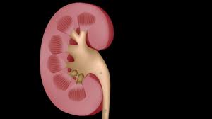 Urology Month Am I Passing A Kidney Stone Youtube