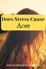 Does Stress Cause Acne Stress Causes Acne Acne Prone Skin