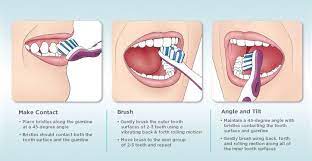 Brushing Technique Outlined By The American Dental Hygienists Association Dental Hygiene Dental Dental Hygienist