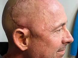 Fundraiser for Frederic Houdaille by Terrence Howse : Fred Houdaille Cancer  Expense Fund