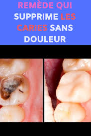 Remede Qui Supprime Les Caries Sans Douleur Movie Posters