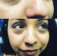 Nose Piercing