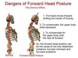 Image result for Neck and Upper Back