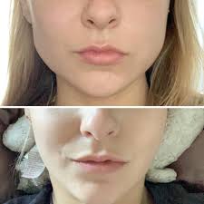 Nina Bui, RN (@ninabuirn) · San Diego, CA