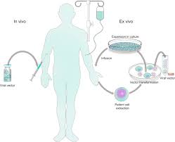 However, the terms transfection and transformation have had varied meanings over time. Viral Vector Platforms Within The Gene Therapy Landscape Signal Transduction And Targeted Therapy