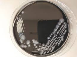Elle est causée par la bactérie legionella, qui vit dans les sources d'eau naturelles et certaines installations, comme les tours de. 23 Personnes Contaminees Par La Legionellose En Flandre On Ignore Toujours La Source