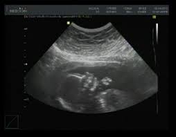 We did not find results for: Hola Reinas D Yo Aqui Esperando Mi 2do Bb Un Varoncito Esperando Mi Segundo Bebe Babycenter