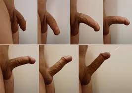 File:ETAPES ERECTION PENIS HOMME.jpg - Wikimedia Commons