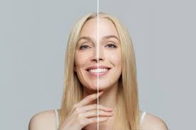 WeekendLIFT™ Insights: Recovery, Benefits & What to Expect